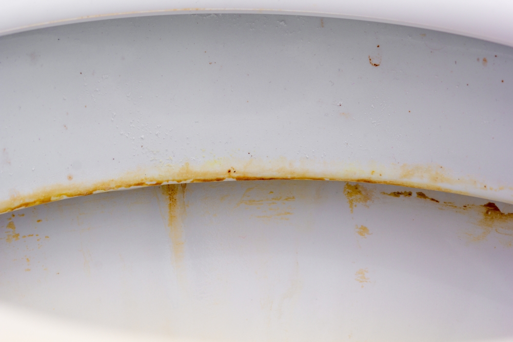 depuneri galbene calcar piatra vas de toaleta soluții 